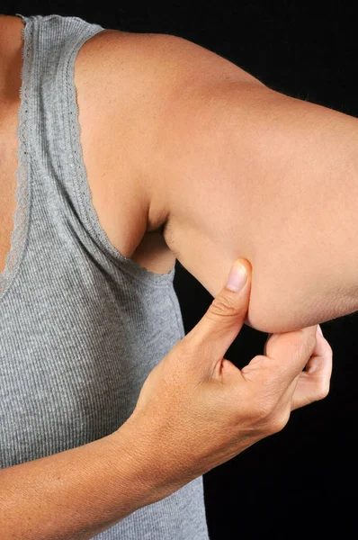 Kvinna Klämma Fett Arm Närbild Svart Bakgrund — Stockfoto