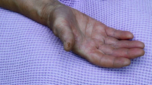Closeup of opened palm hand of senior woman of 80 year old. Mature skin hand care concept. Begging gesture
