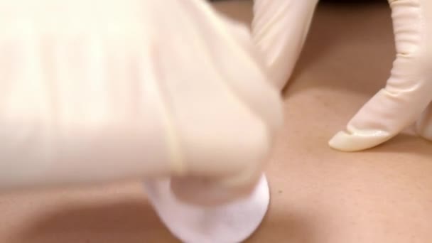 Slow motion close-up meester veegt navel voor desinfectie — Stockvideo