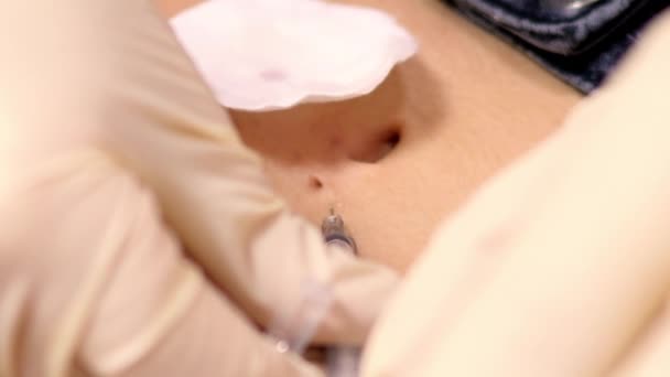 Slow motion close-up meester doet pijnstiller navel injectie — Stockvideo