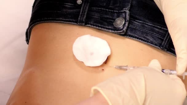 Slowmotion specialist gör bedövningsmedel injektion på naveln — Stockvideo