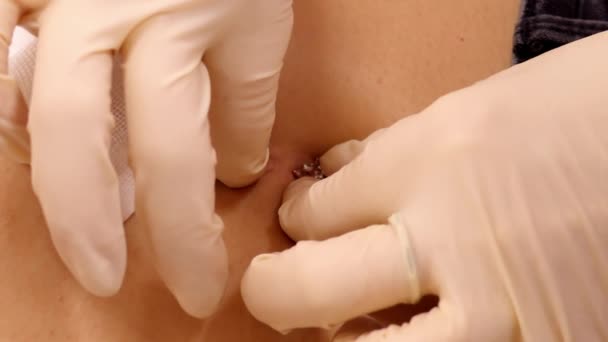 Slow motion closeup master puts belly button ring into navel — Stock Video