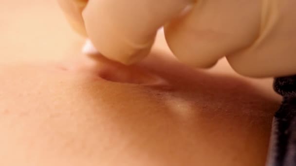 Cámara lenta primer plano piercing maestro desinfecta la piel en el ombligo — Vídeos de Stock