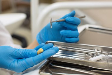 Klinikte diş ve diş aletleri tutan eller.. 