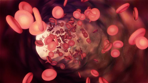 Illustration Une Circulation Sanguine Avec Globules Rouges Plaquettes — Photo