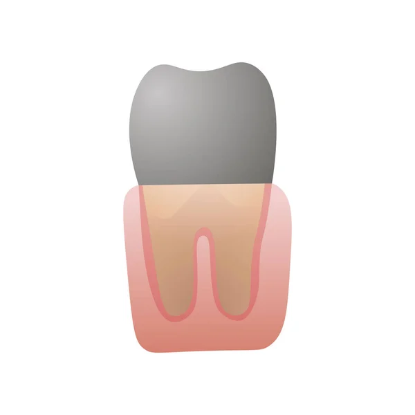 Cárie preta dente doente, gabinete de estomatologia moderna —  Vetores de Stock