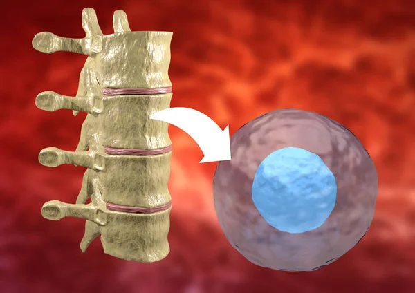 Terapia con células madre tomadas de la médula ósea para tratar enfermedades del cuerpo humano — Foto de Stock