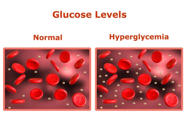 Glucose levels in the blood, table with normal levels and another table indicating diabetes.