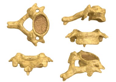 morphology of the cervical vertebra, sixth cervical vertebra, multiple angles and views clipart