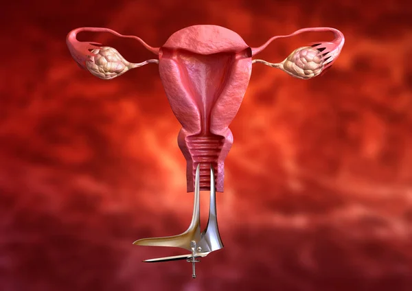 Pap smear è un esame ginecologico della citologia cervicale eseguito come prevenzione del cancro del collo dell'utero . — Foto Stock