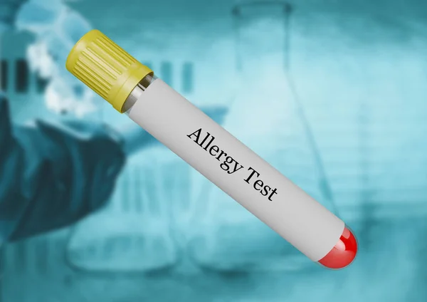 Bloed allergietest verzameld in reageerbuis geïsoleerd door selectieve focus — Stockfoto