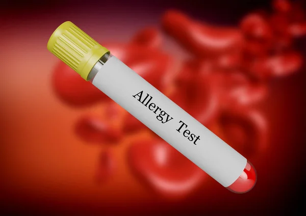 Teste de alergia ao sangue coletado em tubo de ensaio isolado por foco seletivo — Fotografia de Stock