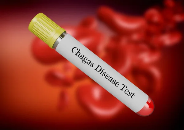 Teste a doença de nastúrcio no sangue coletado em tubo de ensaio isolado por foco seletivo — Fotografia de Stock