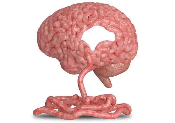 Alzheimers sjukdom hjärn konceptet. Progressiv neurodegenerativ sjukdom manifesterar med kognitiv och minnesförsämring — Stockfoto