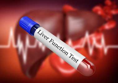 Blood sample in test tube for examination of liver function in laboratory clipart