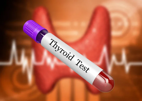 Amostra de sangue no tubo de teste para exame hormonal da glândula tireóide em laboratório — Fotografia de Stock