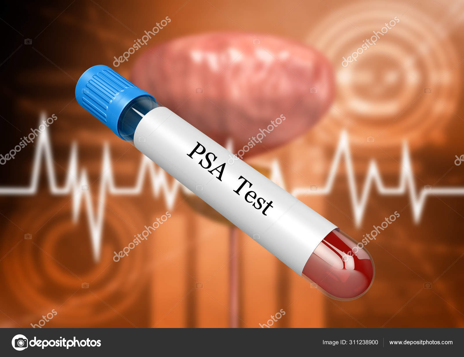 Rmn prostata multiparametrica con mdc | Prostaffect În România