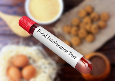 Blood sample in test tube for food intolerance test in laboratory clipart