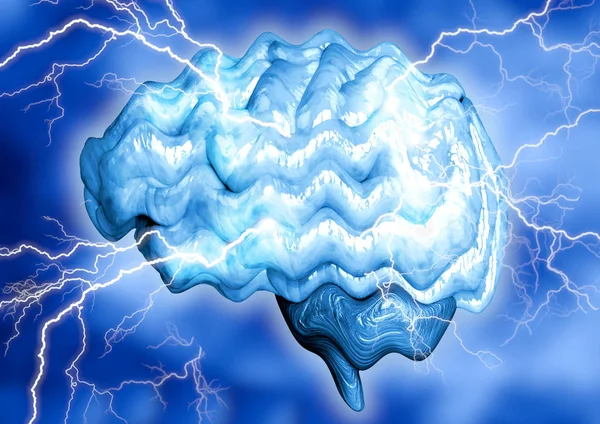Epilepsy is a chronic brain disease caused by increased electrical activity of neurons. It manifests through involuntary convulsions and momentary loss of consciousness. — Stock Photo, Image