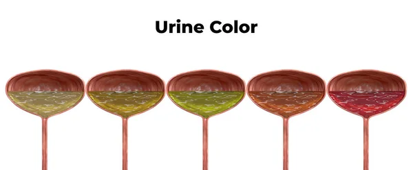 Blære isoleret på hvid baggrund med urin farve sortering. Urin farvning hjælper ved diagnosticering af urinvejssygdomme - Stock-foto
