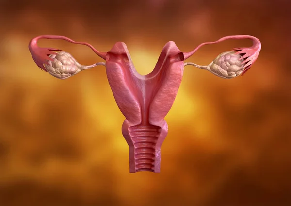 Malformazione uterina. Questi sono cambiamenti nell'utero che possono diminuire le probabilità di gravidanza per il concepimento naturale o artificiale — Foto Stock