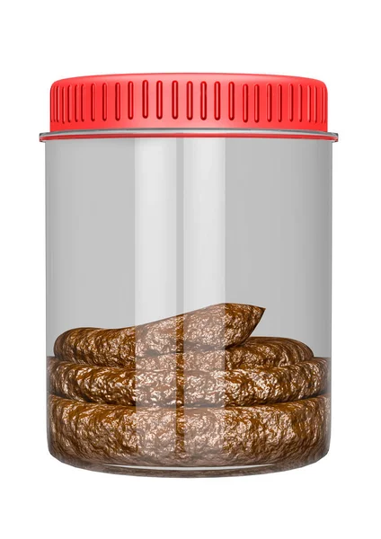 実験室での検査及び疾病検知のための分離瓶中のヒト糞のサンプル — ストック写真