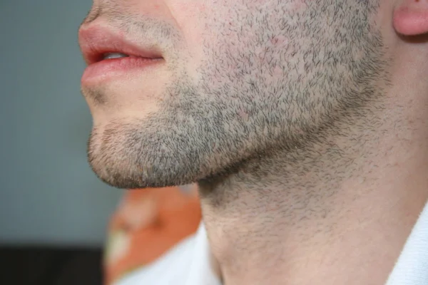 わずかなひげの男の顔 数日は 男のあごにひげ プロファイルからマクロ撮影 — ストック写真