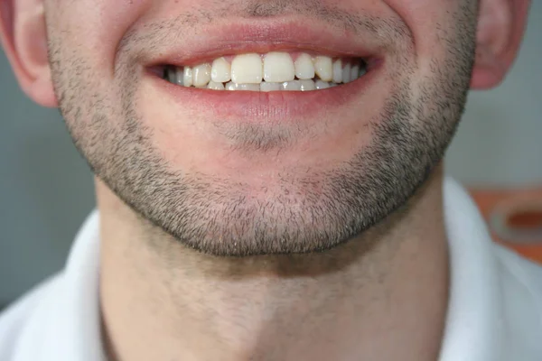 Sorriso Jovem Com Uma Leve Barba Cara Sorri Mostra Dentes — Fotografia de Stock