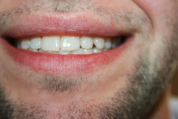 Una Sonrisa Joven Con Una Ligera Barba Tipo Sonríe Muestra — Foto de Stock