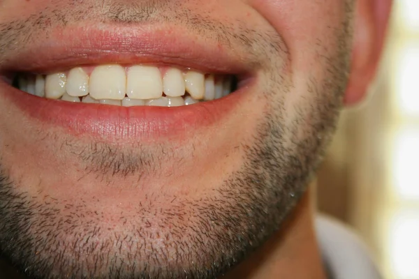 Sorriso Jovem Com Uma Leve Barba Cara Sorri Mostra Dentes — Fotografia de Stock