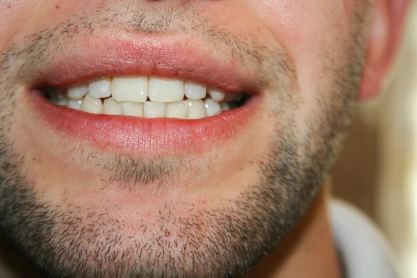 Una Sonrisa Joven Con Una Ligera Barba Tipo Sonríe Muestra — Foto de Stock