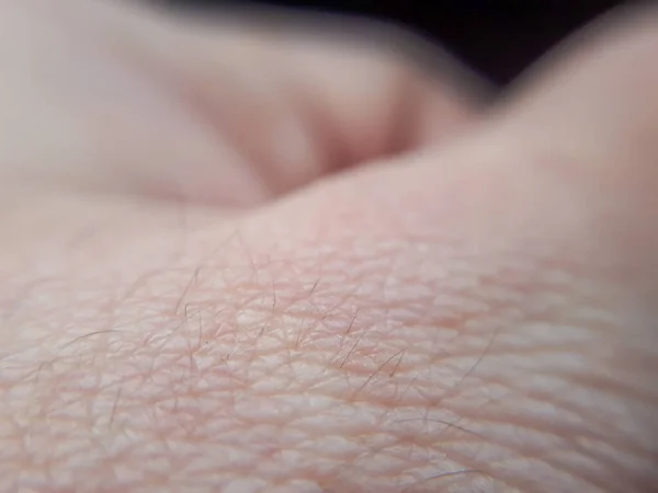 Människans Hud Närbild Dermatologi Bakgrund Abstrakt Detalj Hand Hud — Stockfoto