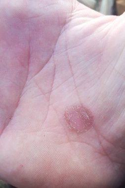 Eldeki işaretler sıkı çalışmanın bir sonucu. El avuç içi dokusu