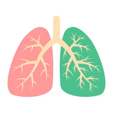 Sağlıklı akciğer ve hastalıklı akciğer. Solunum sistemi. Zatürree, astım, akciğer kanseri olan bir hasta. Hastalığa neden olan virüsler ve bakteriler. Vektör illüstrasyonu