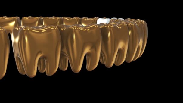 White tooth in a row of the gold teeth. 3D. — Stock Video