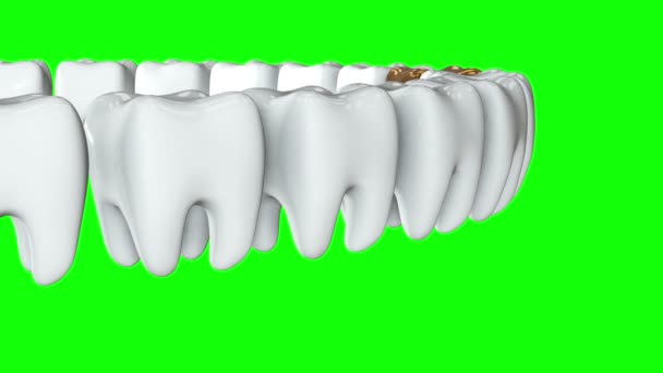 Golden tooth in a row of the white teeth. 3D. — Stock Video