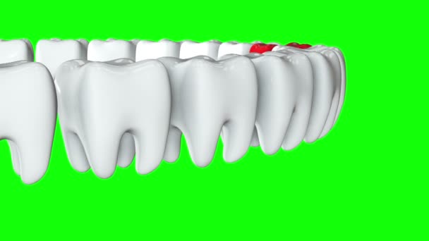 Красный зуб в ряд белых зубов. 3D . — стоковое видео