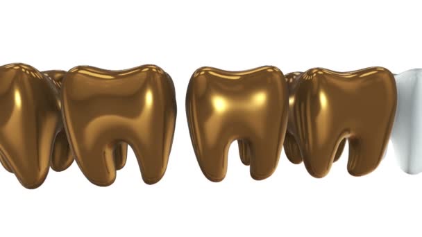 Dente branco em uma fileira dos dentes de ouro. 3D . — Vídeo de Stock