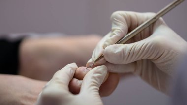 Profesyonel pedicurist koruyucu eldiven giymiş pedikür yapım closeup.
