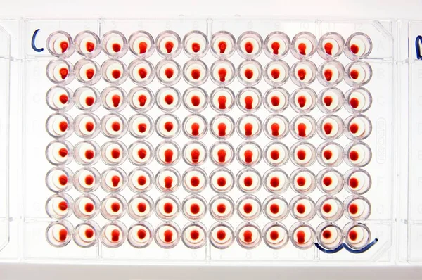 Pohled Vysokého Úhlu Krevních Vzorků Laboratoři Kliniky — Stock fotografie