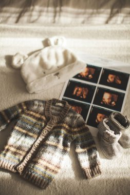 Küçük el bebek giysileri yaptı. Ultrason fotoğrafını. Yenidoğan kıyafetleri bej yün arka plan üzerinde. Mutluluk
