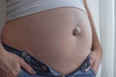 Göbek fıtığı hamile bir kadın. Portre