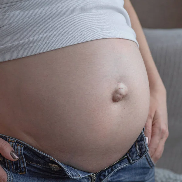 Umbilical hernia in a pregnant woman. Closeup — Stock Image Umbilical hernia in a pregnant woman. Closeup Stock Picture