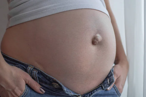 Umbilical hernia in a pregnant woman. Closeup — Stock Image Umbilical hernia in a pregnant woman. Closeup Stock Picture