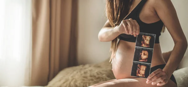 Mujer embarazada sosteniendo imagen de ultrasonido. Concepto de embarazo, cuidado de la salud, ginecología, medicina — Foto de Stock