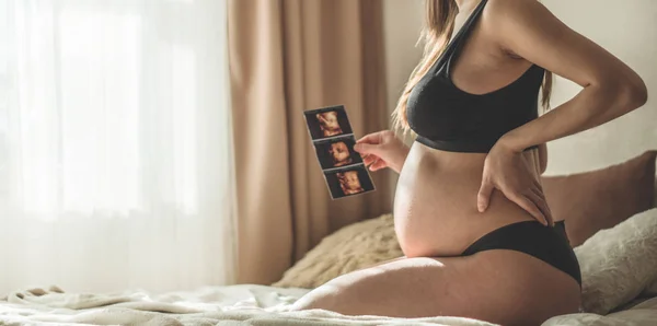 Schwangere mit Ultraschallbild. Konzept Schwangerschaft, Gesundheitsfürsorge, Gynäkologie, Medizin — Stockfoto