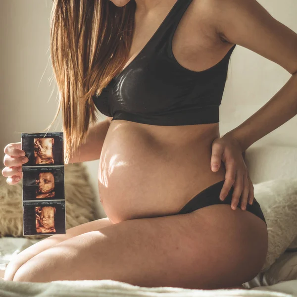 Femme enceinte tenant une image échographique. Concept de grossesse, soins de santé, gynécologie, médecine — Photo