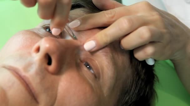 Косметологи выщипывают волосы между бровями человека, который закрывает глаза — стоковое видео