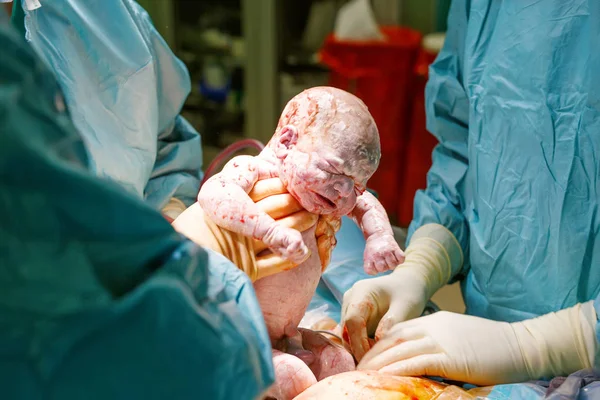 Baby being born via Caesarean Section coming out. Newborn child seconds and minutes after birth. New life, beginning, healthcare — Stock Photo, Image