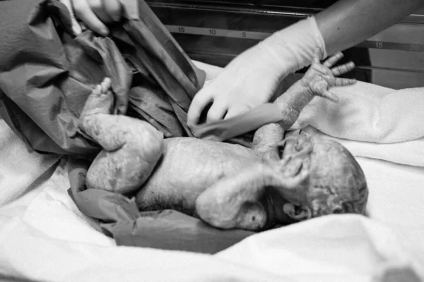 Recién nacido segundos y minutos después del nacimiento. El bebé nace por cesárea. El doctor le da la mano a una recién nacida. Nueva vida, inicio, salud — Foto de Stock